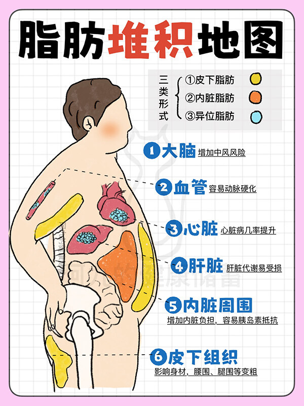 了解脂肪堆積地圖